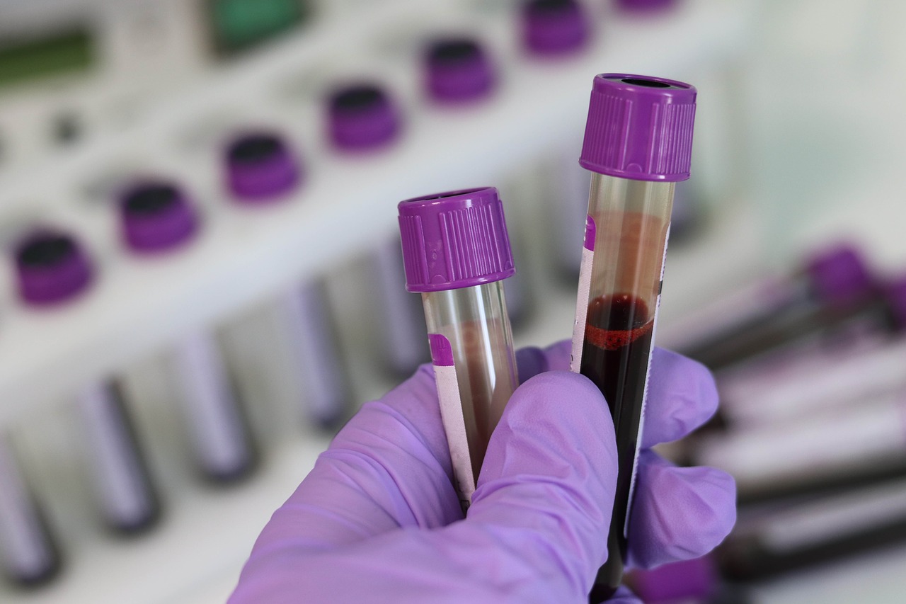New Zealand: Why Can’t Gay Men Donate Blood?